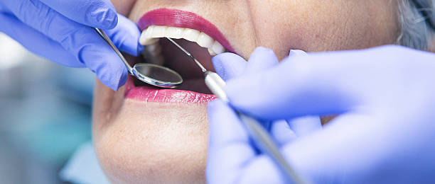 Best Emergency Wisdom Tooth Extraction in New Castle, IN